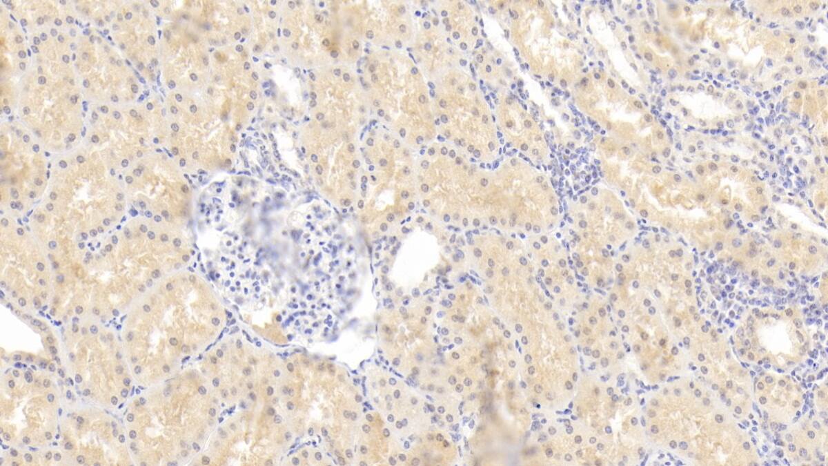 RHD Antibody (C7)