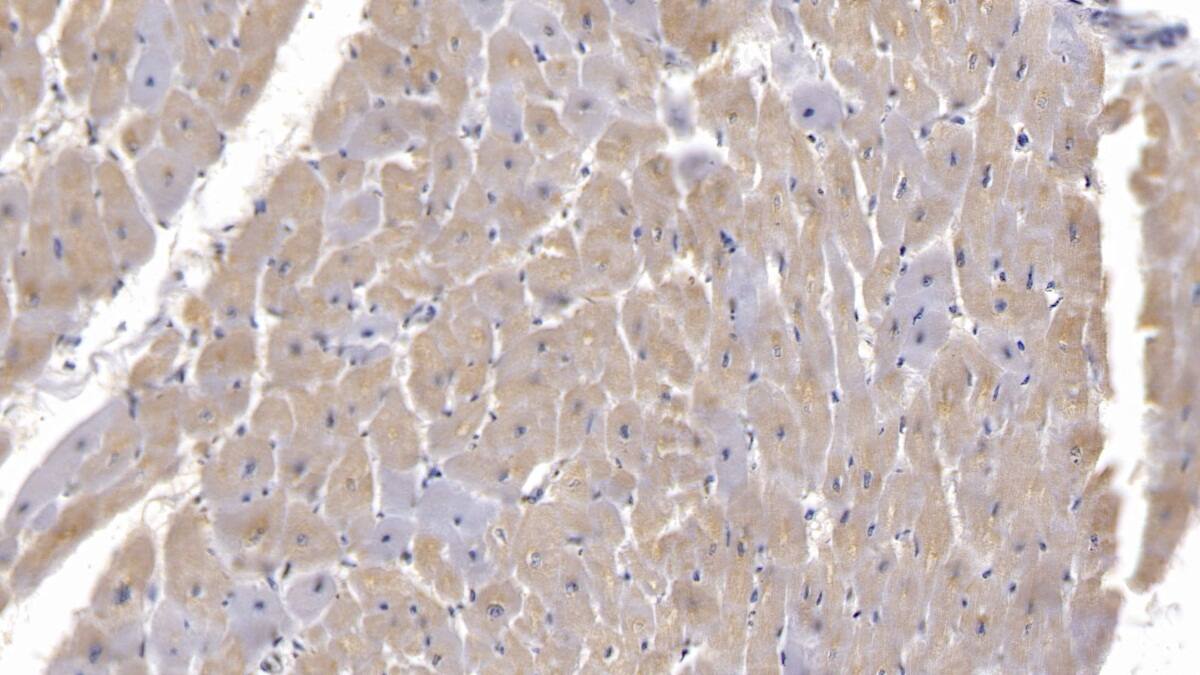 Semaphorin 5B Antibody (C17)