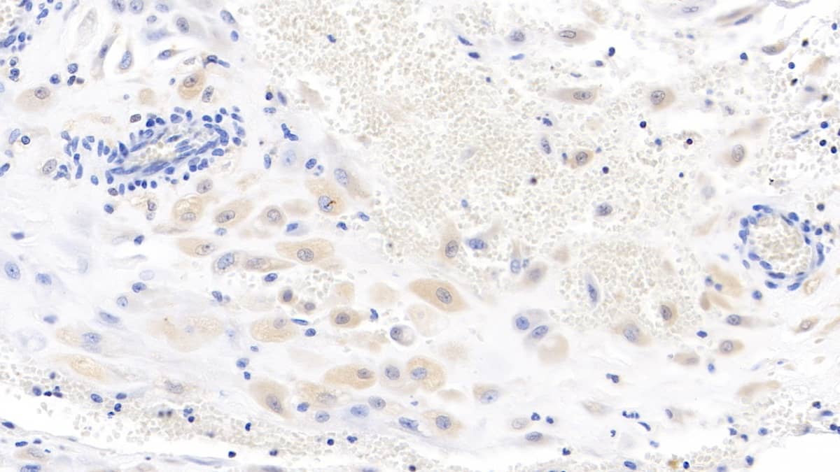 Wnt-3a Antibody (C1)