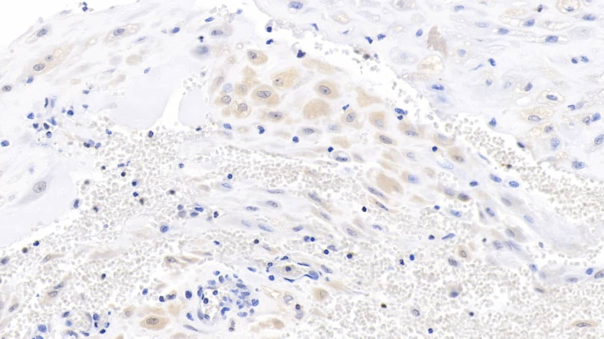 Wnt-3a Antibody (C15)