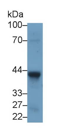 Wnt-5a Antibody (C3)