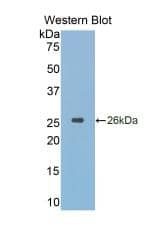 Cathepsin K Antibody (1#)