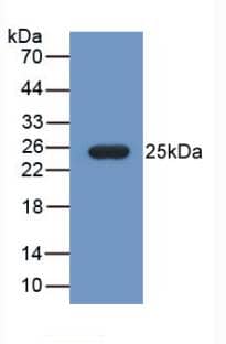 Fibulin 1 Antibody (C12)