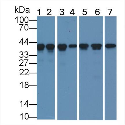 Actin Alpha 1 Cardiac Muscle Antibody (C4)