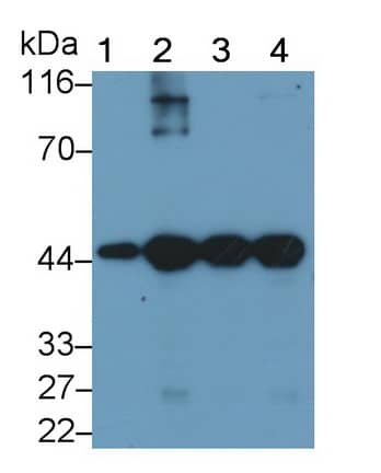 Actin Alpha 1 Cardiac Muscle Antibody (C302)