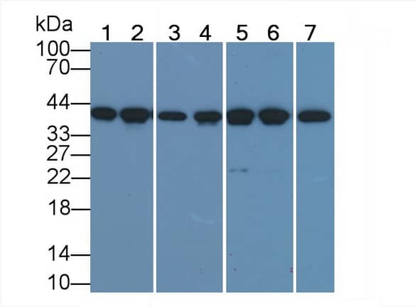 Actin Alpha 1 Cardiac Muscle Antibody (C6)