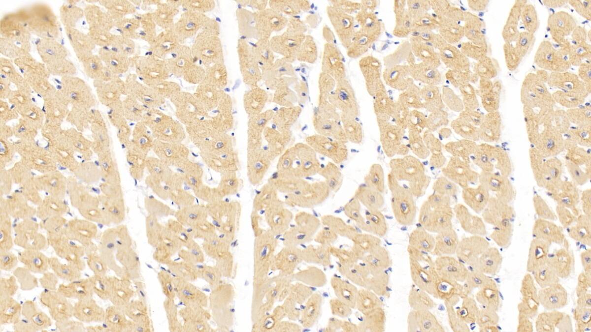 Actin Alpha 1 Cardiac Muscle Antibody (C304)