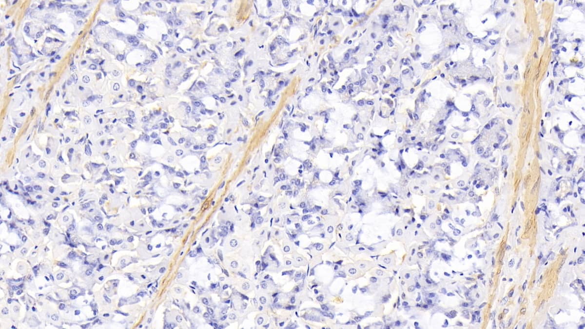 Actin Alpha 1 Cardiac Muscle Antibody (C304)