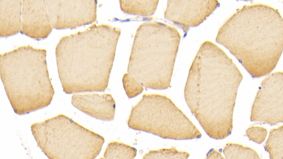 Actin Alpha 1 Cardiac Muscle Antibody (C304)