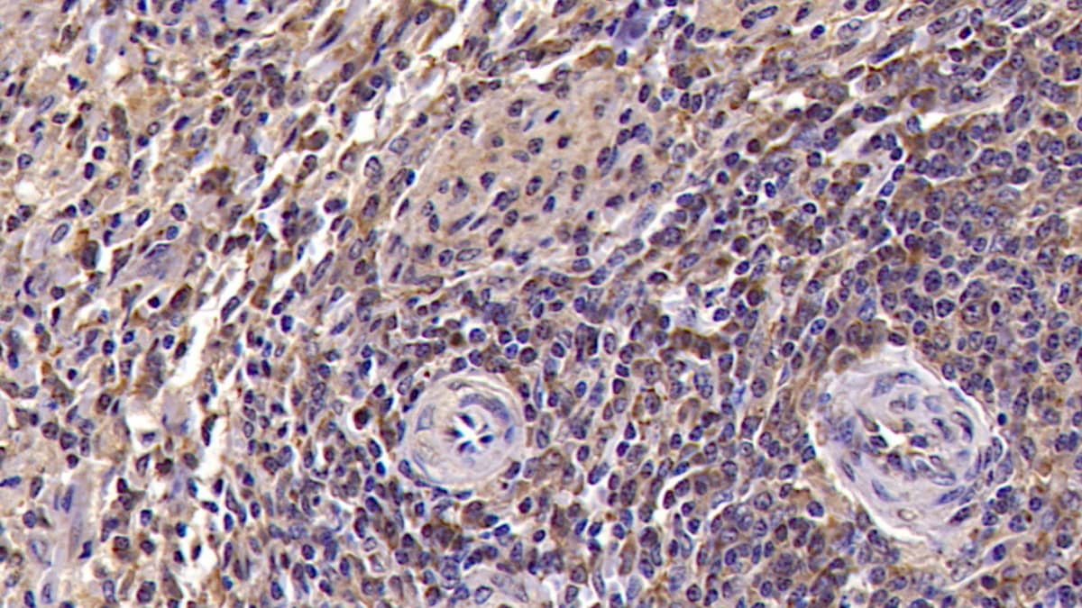 CD94 Antibody (C2)