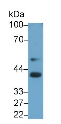 BMP-3 Antibody (D5)