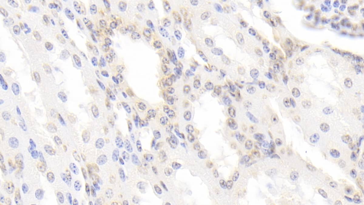 BMP-3 Antibody (C2)