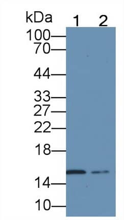 Hemoglobin A1 Antibody (C5)