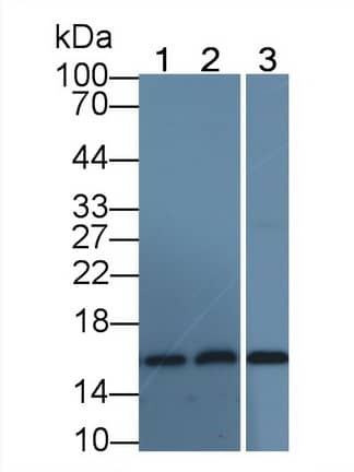 Hemoglobin A1 Antibody (C6)