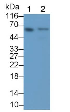 TRIM8 Antibody (D1)