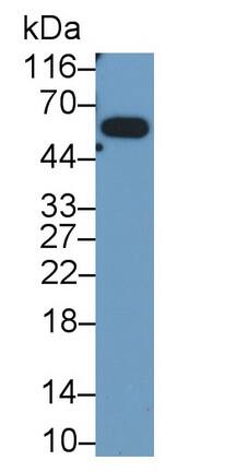 TRIM8 Antibody (D2)