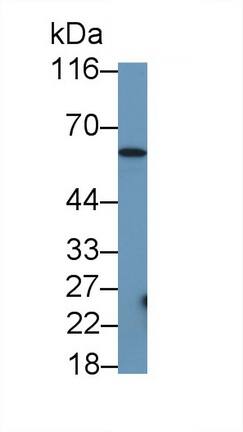 TRIM8 Antibody (D5)