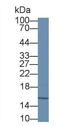 Hemoglobin A1 Antibody (C7)