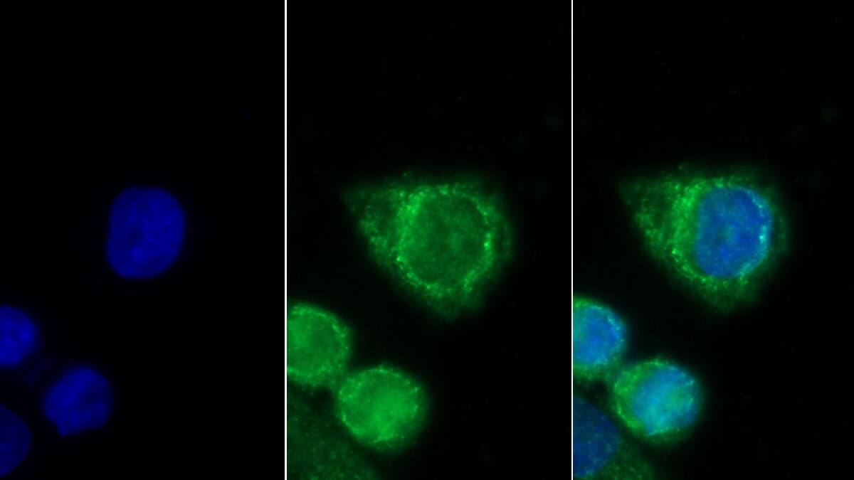 TRIM8 Antibody (D6)