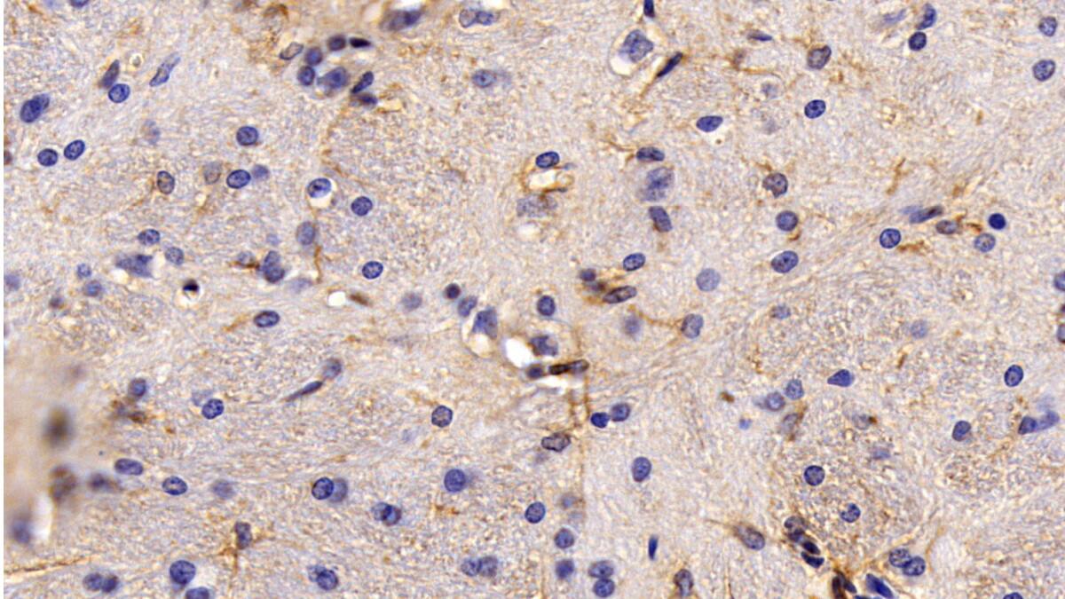 TRIM8 Antibody (D13)