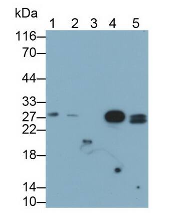 EPDR1 Antibody (C3)