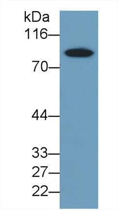 Thrombin-antithrombin (TAT) complexes Antibody (C1)