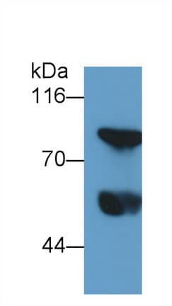 Thrombin-antithrombin (TAT) complexes Antibody (C4)