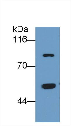 Thrombin-antithrombin (TAT) complexes Antibody (C7)