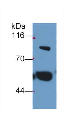 Thrombin-antithrombin (TAT) complexes Antibody (C3)