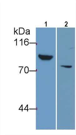 Thrombin-antithrombin (TAT) complexes Antibody (C6)