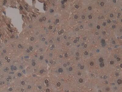 TNP1 Antibody
