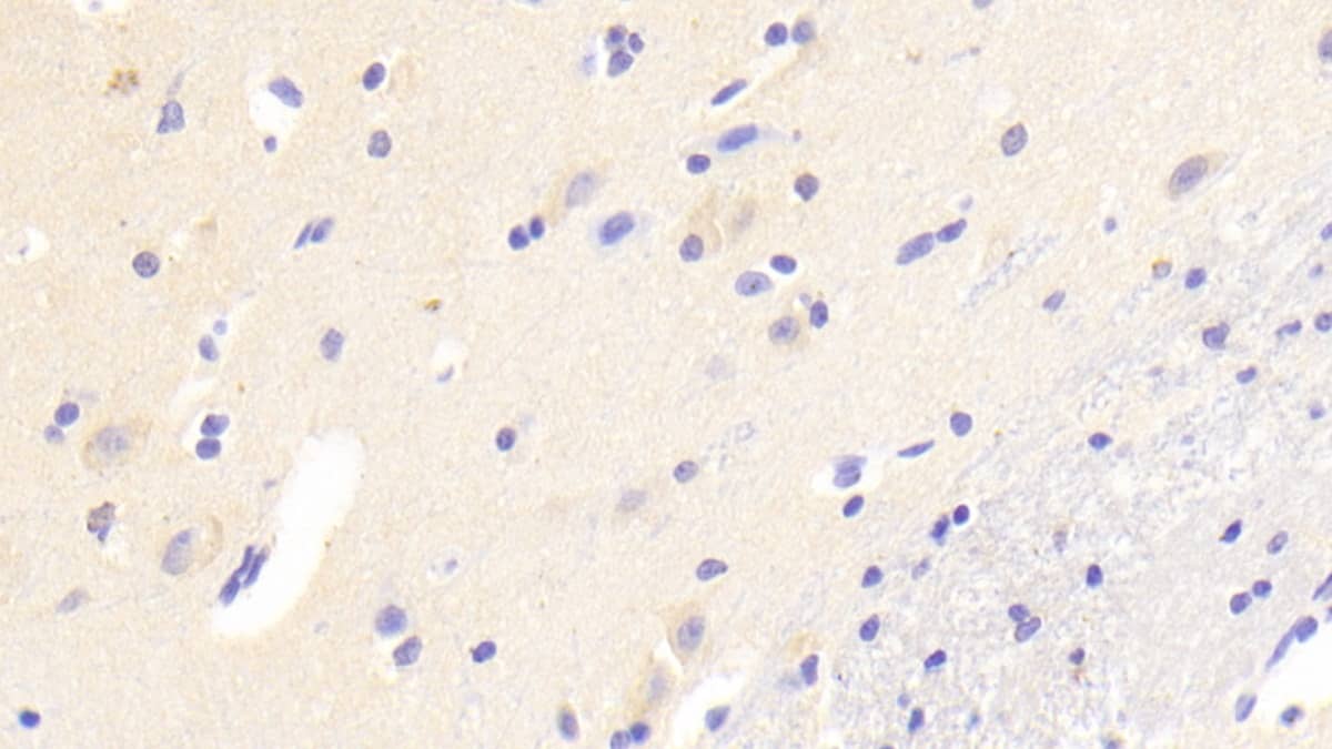 AIG1 Antibody