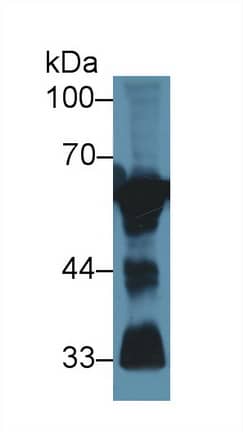 Calcineurin Antibody