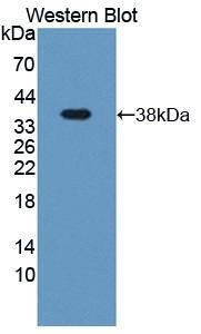 Latent TGF-beta bp2/LTBP-2 Antibody