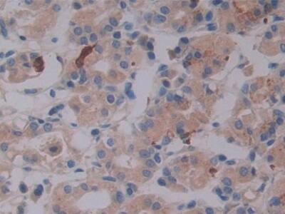 Latent TGF-beta bp2/LTBP-2 Antibody