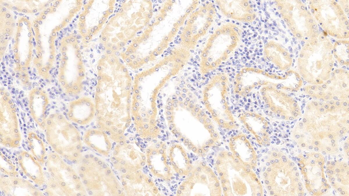 HLA-E Antibody