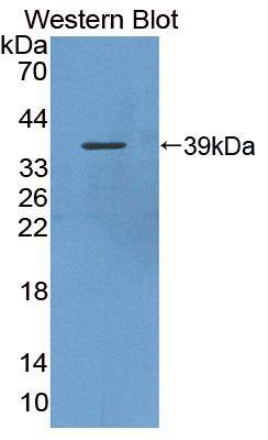 SBEM Antibody