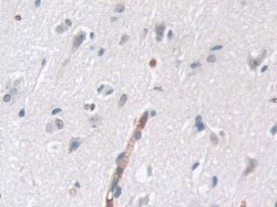 TTBK1 Antibody