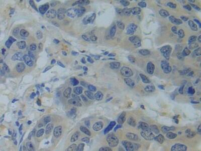 SNRPC Antibody