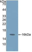 Gastrin-releasing Peptide/Bombesin/Neuromedin C Antibody