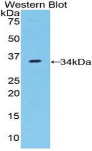 NUP205 Antibody