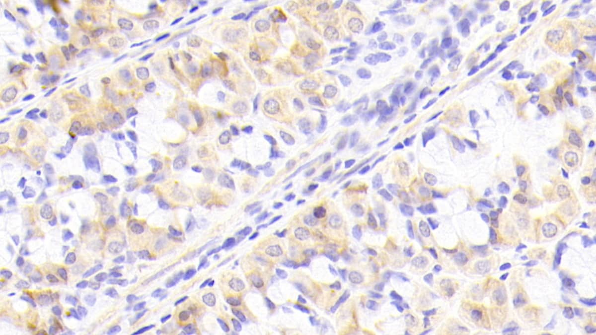 NUP205 Antibody