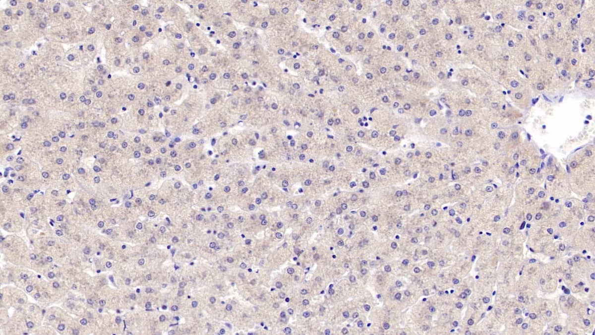 CCL23/Ck beta 8-1/MIP3 Antibody