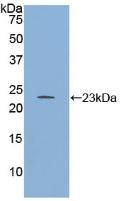 RGS4 Antibody