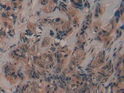 Fibrillin 2 Antibody