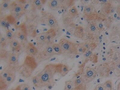 Plakophilin 2 Antibody