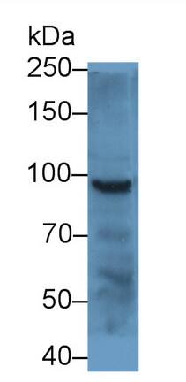 Plakophilin 2 Antibody