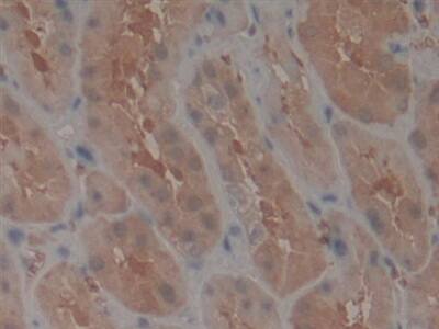 TEP1 Antibody