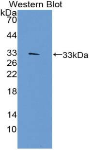 TEP1 Antibody