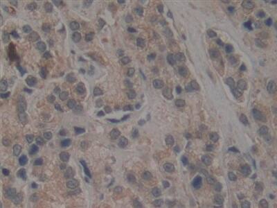 TEP1 Antibody